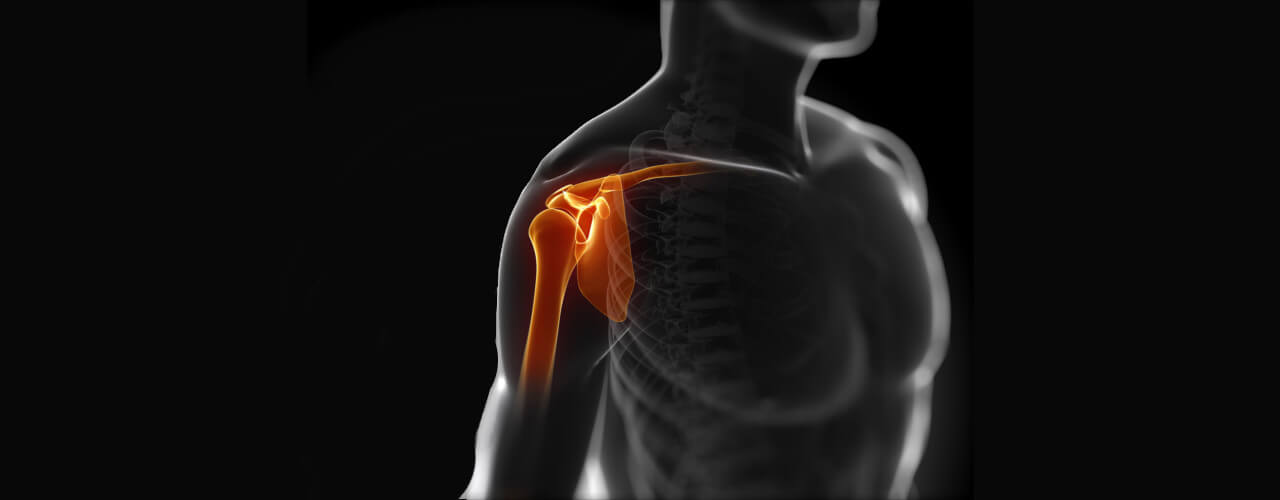 Shoulder Pain Relief Tulsa  Book Your Appointment at Recover Therapy!